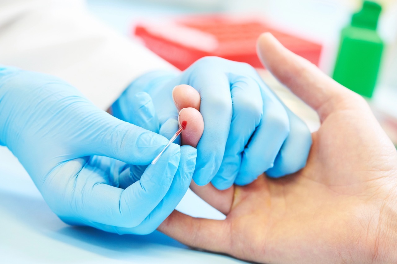 Blood medical test or research. Taking a blood sample from male finger in hospital